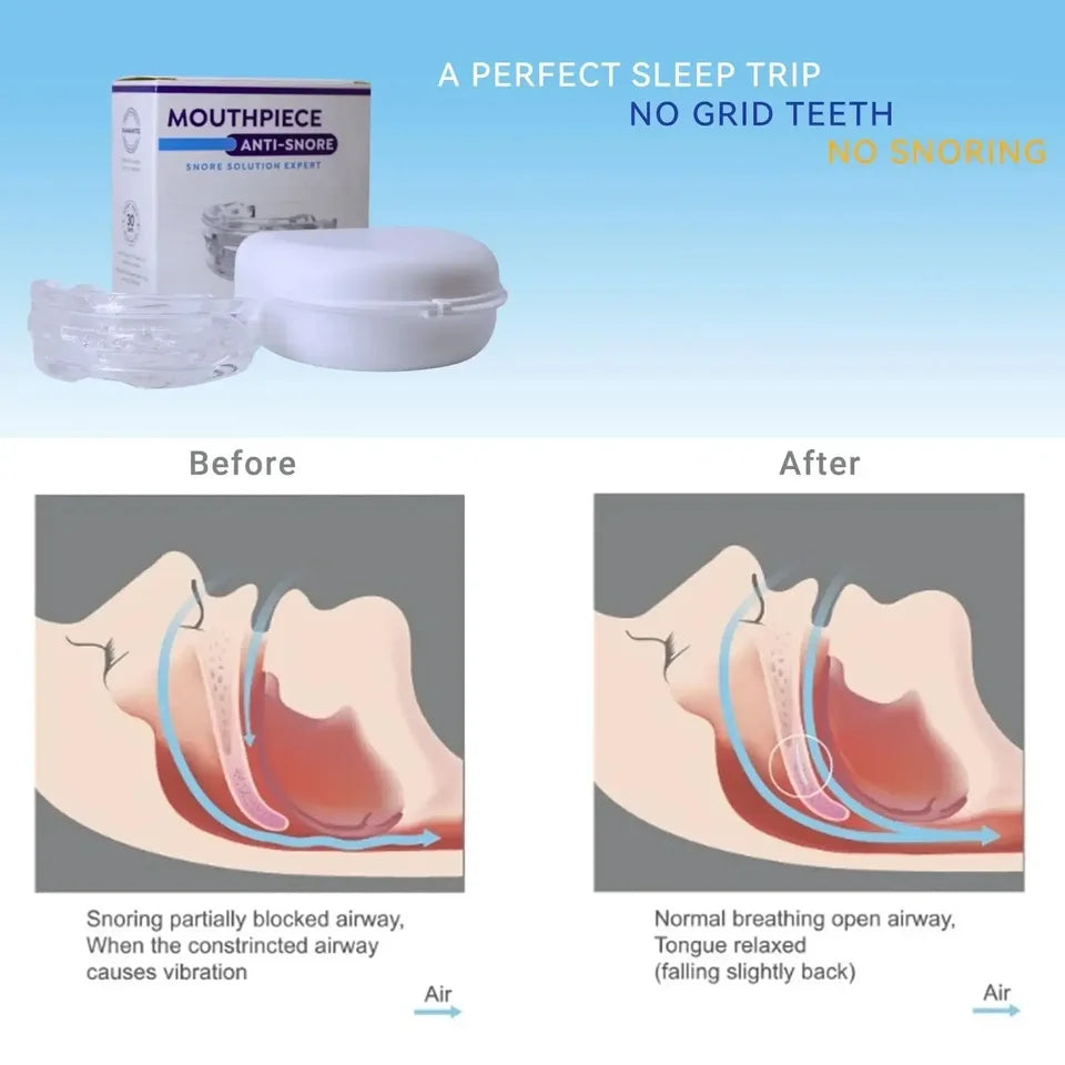 Adjustable Anti-Snoring Mouthguard for Restful Sleep